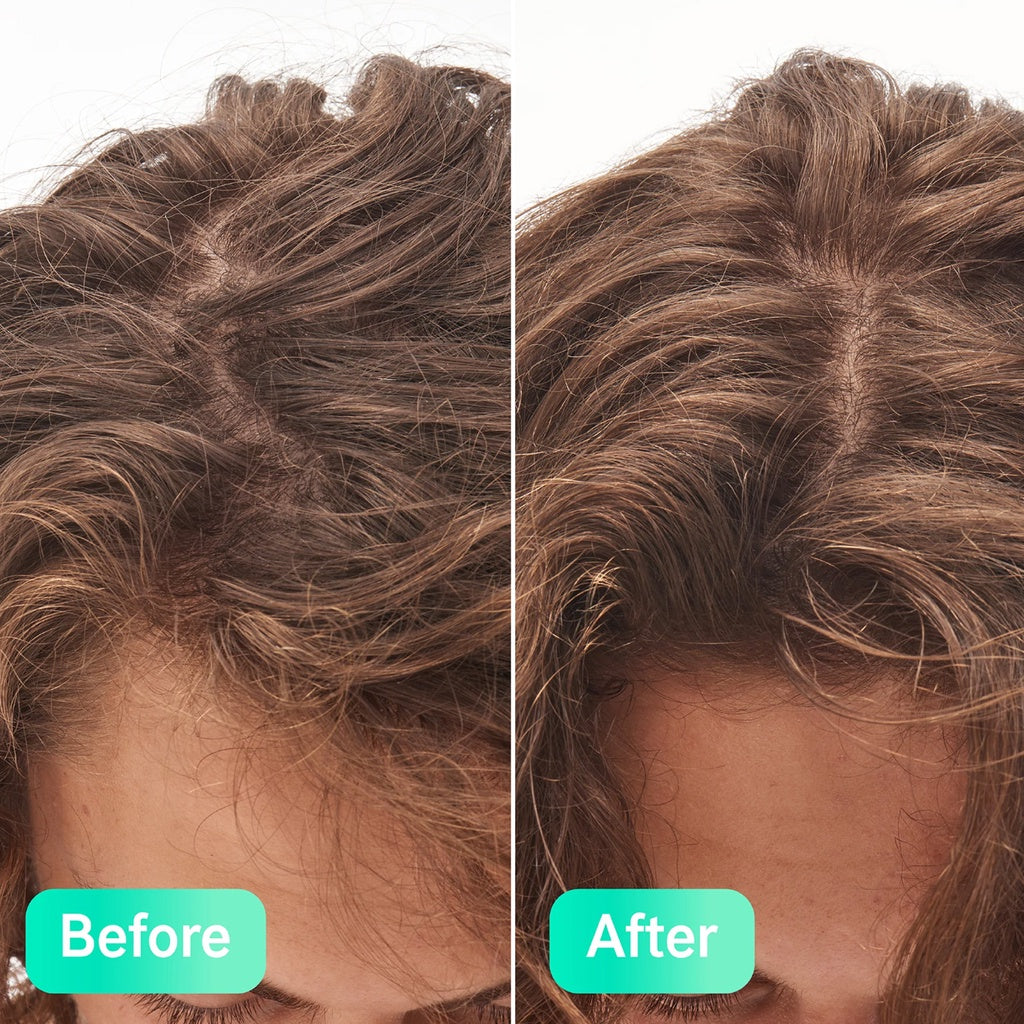 The Inkey List Glycolic Acid Exfoliating Scalp Scrub 150ml | Removes Product Buildup