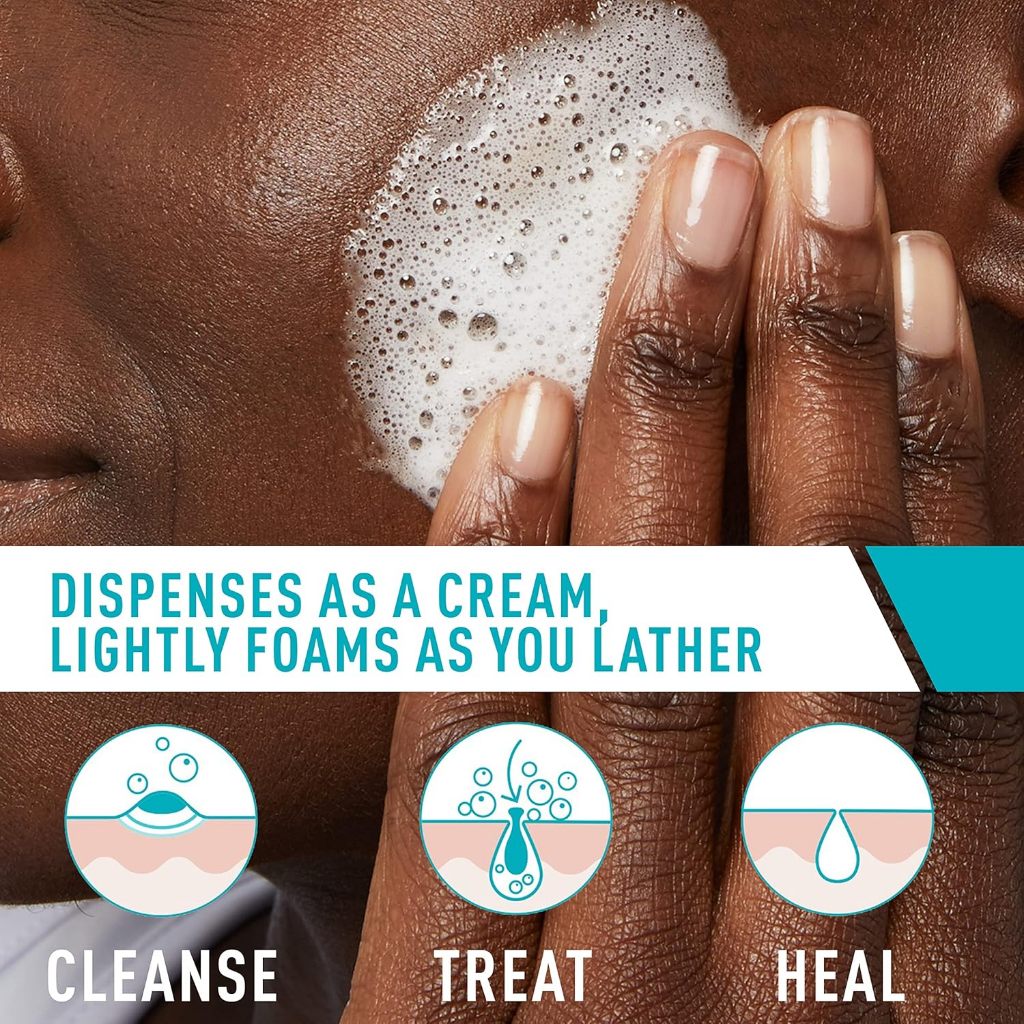 Cerave Acne Foaming Cream Cleanser 150ml EXP 06.26 | Clears Acne & Blackheads